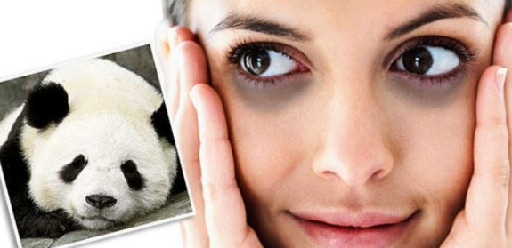 Cara menghilangkan mata panda permanen