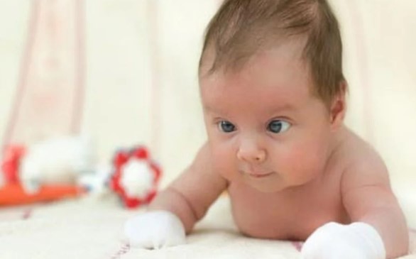 Cara Mengatasi Mata Juling Pada Bayi