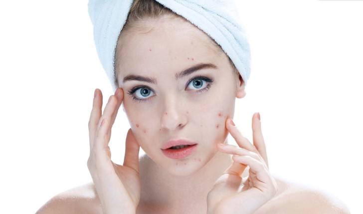 Dampak Negatif Air Mata bagi Kulit